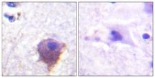 MAP4 Antibody - Immunohistochemistry analysis of paraffin-embedded human brain tissue, using MAP4 Antibody. The picture on the right is blocked with the synthesized peptide.