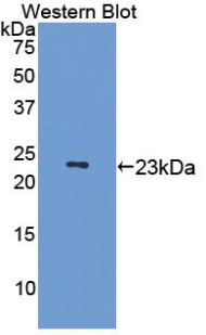 MAP4 Antibody - Western blot of MAP4 antibody.