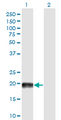 MAP4 Antibody - Western blot of MAP4 expression in transfected 293T cell line by MAP4 monoclonal antibody (M03), clone 7C9.