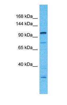 MAP4 Antibody - Western blot of MAP4 Antibody with human 786-0 Whole Cell lysate.  This image was taken for the unconjugated form of this product. Other forms have not been tested.