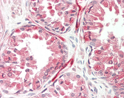 MAP4 Antibody - Human Prostate: Formalin-Fixed, Paraffin-Embedded (FFPE).  This image was taken for the unconjugated form of this product. Other forms have not been tested.