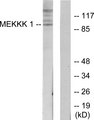 MAP4K1 / HPK1 Antibody - Western blot analysis of lysates from HepG2 cells, using MEKKK 1 Antibody. The lane on the right is blocked with the synthesized peptide.