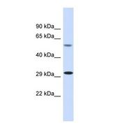 MAP4K1 / HPK1 Antibody - Western blot of Human Fetal Muscle. MAP4K1 antibody dilution 1.0 ug/ml.  This image was taken for the unconjugated form of this product. Other forms have not been tested.