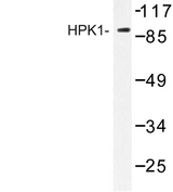 MAP4K1 / HPK1 Antibody - Western blot of HPK1 (L397) pAb in extracts from HepG2 cells.