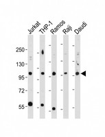 MAP4K1 / HPK1 Antibody - All lanes: Anti-Phospho-MAP4K1-T165 Antibody, ctrl at 1:1000-2000 dilution Lane 1: Jurkat whole cell lysate Lane 2: THP-1 whole cell lysate Lane 3: Ramos whole cell lysate Lane 4: Raji whole cell lysate Lane 5: Daudi whole cell lysate Lysates/proteins at 20 µg per lane. Secondary Goat Anti-Rabbit IgG, (H+L), Peroxidase conjugated at 1/10000 dilution. Predicted band size: 91 kDa Blocking/Dilution buffer: 5% NFDM/TBST.