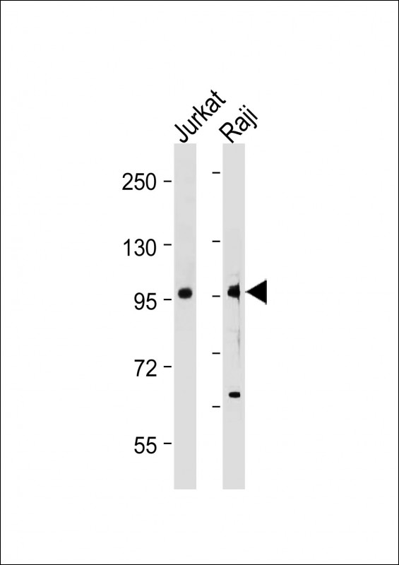 MAP4K1 / HPK1 Antibody - All lanes: Anti-MAP4K1 (Y381) Antibody at 1:2000 dilution Lane 1: Jurkat whole cell lysate Lane 2: Raji whole cell lysate Lysates/proteins at 20 µg per lane. Secondary Goat Anti-Rabbit IgG, (H+L), Peroxidase conjugated at 1/10000 dilution. Predicted band size: 91 kDa Blocking/Dilution buffer: 5% NFDM/TBST.