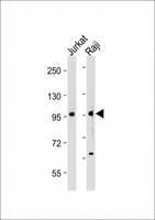 MAP4K1 / HPK1 Antibody - All lanes: Anti-MAP4K1 (Y381) Antibody at 1:2000 dilution Lane 1: Jurkat whole cell lysate Lane 2: Raji whole cell lysate Lysates/proteins at 20 µg per lane. Secondary Goat Anti-Rabbit IgG, (H+L), Peroxidase conjugated at 1/10000 dilution. Predicted band size: 91 kDa Blocking/Dilution buffer: 5% NFDM/TBST.