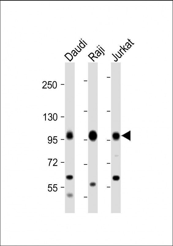 MAP4K1 / HPK1 Antibody - All lanes: Anti-MAP4K1 Antibody at 1:2000 dilution Lane 1: Daudi whole cell lysate Lane 2: Raji whole cell lysate Lane 3: Jurkat whole cell lysate Lysates/proteins at 20 µg per lane. Secondary Goat Anti-Rabbit IgG, (H+L), Peroxidase conjugated at 1/10000 dilution. Predicted band size: 91 kDa Blocking/Dilution buffer: 5% NFDM/TBST.