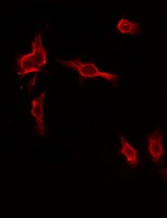 MAP4K1 / HPK1 Antibody - Staining HepG2 cells by IF/ICC. The samples were fixed with PFA and permeabilized in 0.1% Triton X-100, then blocked in 10% serum for 45 min at 25°C. The primary antibody was diluted at 1:200 and incubated with the sample for 1 hour at 37°C. An Alexa Fluor 594 conjugated goat anti-rabbit IgG (H+L) Ab, diluted at 1/600, was used as the secondary antibody.