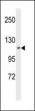 MAP4K3 / GLK Antibody - Western blot of MAP4K3 Antibody in HepG2 cell line lysates (35 ug/lane). MAP4K3 (arrow) was detected using the purified antibody.
