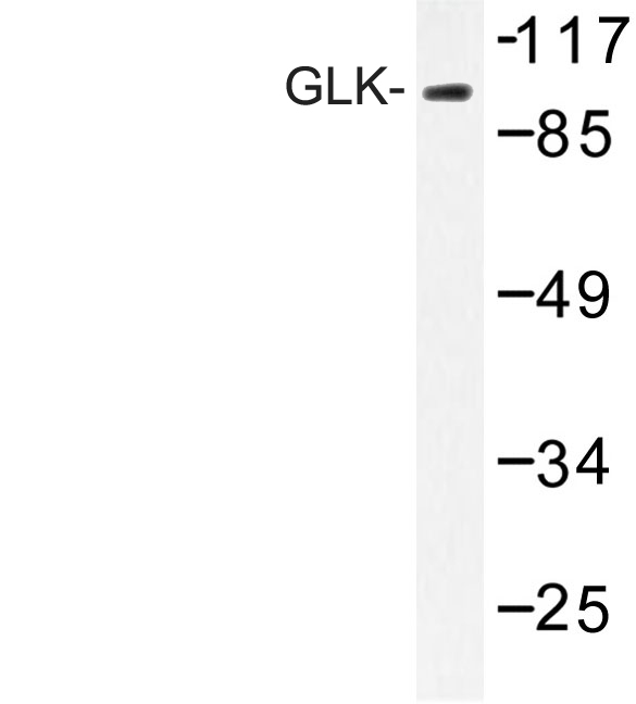 MAP4K3 / GLK Antibody - Western blot of GLK (G4) pAb in extracts from K562 cells.