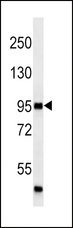 MAP4K3 / GLK Antibody - MAP4K3 western blot of A2058 cell line lysates (35 ug/lane). The MAP4K3 antibody detected the MAP4K3 protein (arrow).