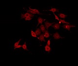 MAP4K3 / GLK Antibody - Staining HepG2 cells by IF/ICC. The samples were fixed with PFA and permeabilized in 0.1% Triton X-100, then blocked in 10% serum for 45 min at 25°C. The primary antibody was diluted at 1:200 and incubated with the sample for 1 hour at 37°C. An Alexa Fluor 594 conjugated goat anti-rabbit IgG (H+L) Ab, diluted at 1/600, was used as the secondary antibody.