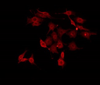 MAP4K3 / GLK Antibody - Staining HepG2 cells by IF/ICC. The samples were fixed with PFA and permeabilized in 0.1% Triton X-100, then blocked in 10% serum for 45 min at 25°C. The primary antibody was diluted at 1:200 and incubated with the sample for 1 hour at 37°C. An Alexa Fluor 594 conjugated goat anti-rabbit IgG (H+L) Ab, diluted at 1/600, was used as the secondary antibody.