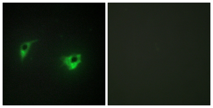 MAP4K4 Antibody - Immunofluorescence analysis of A549 cells, using MEKKK 4 Antibody. The picture on the right is blocked with the synthesized peptide.