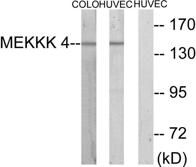 MAP4K4 Antibody - Western blot analysis of lysates from HUVEC and COLO cells, using MEKKK 4 Antibody. The lane on the right is blocked with the synthesized peptide.