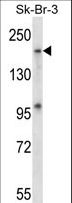 MAP4K4 Antibody - Mouse Map4k4 Antibody western blot of SK-BR-3 cell line lysates (35 ug/lane). The Map4k4 antibody detected the Map4k4 protein (arrow).