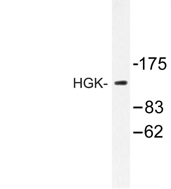 MAP4K4 Antibody - Western blot of HGK (R430) pAb in extracts from HUVEC cells.