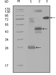 MAP4K4 Antibody - Western blot using MAP4K4 mouse monoclonal antibody against truncated Trx-MAP4K4 recombinant protein (1), MBP-MAP4K4 (aa300-400) recombinant protein (2) and MAP4K4(aa194-436)-hIgGFc transfected CH0-K1 cell lysate(3).