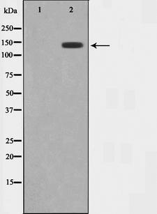 MAP4K4 Antibody - Western blot analysis on HuvEc cell lysates using MEKKK 4 antibody. The lane on the left is treated with the antigen-specific peptide.