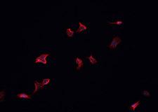 MAP4K4 Antibody - Staining HeLa cells by IF/ICC. The samples were fixed with PFA and permeabilized in 0.1% Triton X-100, then blocked in 10% serum for 45 min at 25°C. The primary antibody was diluted at 1:200 and incubated with the sample for 1 hour at 37°C. An Alexa Fluor 594 conjugated goat anti-rabbit IgG (H+L) antibody, diluted at 1/600, was used as secondary antibody.