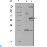 MAP4K4 Antibody - Western Blot (WB) analysis using HGK Monoclonal Antibody against truncated Trx-HGK recombinant protein (1), MBP-HGK (aa300-400) recombinant protein (2) and HGK(aa194-436)-hIgGFc transfected CH0-K1 cell lysate(3).