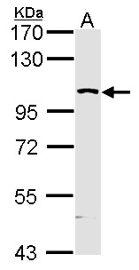 MAP4K5 Antibody - Sample (30 ug of whole cell lysate). A: Molt-4 . 12% SDS PAGE. MAP4K5 antibody. MAP4K5 antibody diluted at 1:5000.