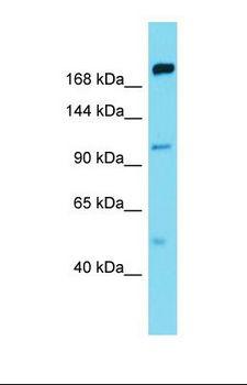 MAP4K5 Antibody - Western blot of Human Thymus Tumor. MAP4K5 antibody dilution 1.0 ug/ml.  This image was taken for the unconjugated form of this product. Other forms have not been tested.