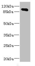 MAP4K5 Antibody - Western blot All Lanes: MAP4K5 antibody at 4.2ug/ml+ Mouse brain tissue Goat polyclonal to rabbit at 1/10000 dilution Predicted band size: 95 kDa Observed band size: 95 kDa