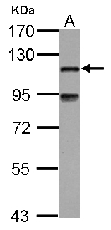 MAP7 Antibody - Sample (30 ug of whole cell lysate) A: A431 7.5% SDS PAGE MAP7 antibody diluted at 1:1000