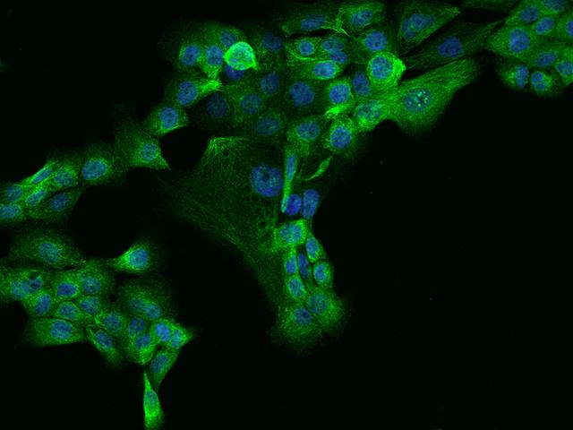 MAP7 Antibody - Immunofluorescence staining of MAP7 in A431 cells. Cells were fixed with 4% PFA, permeabilzed with 0.1% Triton X-100 in PBS, blocked with 10% serum, and incubated with rabbit anti-Human MAP7 polyclonal antibody (dilution ratio 1:200) at 4°C overnight. Then cells were stained with the Alexa Fluor 488-conjugated Goat Anti-rabbit IgG secondary antibody (green) and counterstained with DAPI (blue). Positive staining was localized to Cytoplasm.