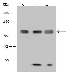 MAP7 Antibody - Anti-MAP7 rabbit polyclonal antibody at 1:500 dilution. Lane A: A549 Whole Cell Lysate. Lane B: A431 Whole Cell Lysate. Lane C: HeLa Whole Cell Lysate. Lysates/proteins at 30 ug per lane. Secondary: Goat Anti-Rabbit IgG (H+L)/HRP at 1/10000 dilution. Developed using the ECL technique. Performed under reducing conditions. Predicted band size: 84 kDa.