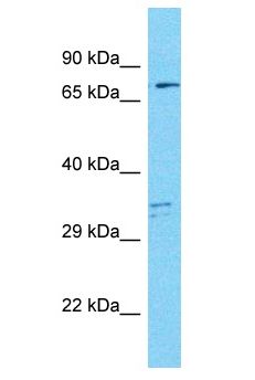 MAP9 Antibody - MAP9 antibody Western Blot of MCF7. Antibody dilution: 1 ug/ml.  This image was taken for the unconjugated form of this product. Other forms have not been tested.