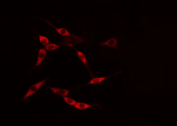 MAP9 Antibody - Staining HuvEc cells by IF/ICC. The samples were fixed with PFA and permeabilized in 0.1% Triton X-100, then blocked in 10% serum for 45 min at 25°C. The primary antibody was diluted at 1:200 and incubated with the sample for 1 hour at 37°C. An Alexa Fluor 594 conjugated goat anti-rabbit IgG (H+L) antibody, diluted at 1/600, was used as secondary antibody.