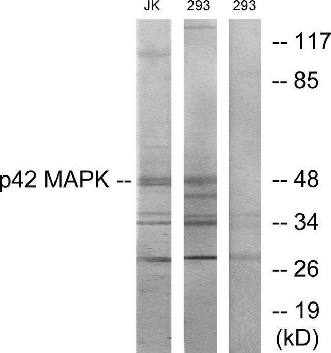 MAPK1 / ERK2 Antibody - Western blot analysis of lysates from Jurkat and 293 cells, using p42 MAPK Antibody. The lane on the right is blocked with the synthesized peptide.