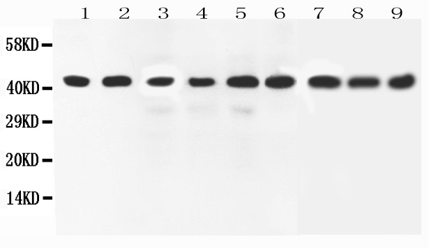 MAPK1 / ERK2 Antibody - Western blot - Anti-ERK2 Antibody