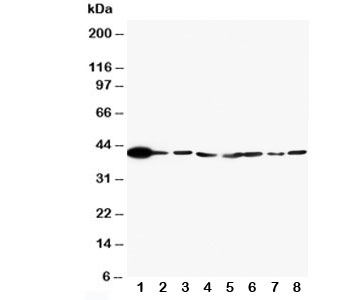 MAPK1 / ERK2 Antibody - Western blot testing of ERK2 antibody and Lane 1: rat brain; 2: rat lung; 3: rat placenta; 4: HT1080; 5: HeLa; 6: MM231; 7: Raji; 8: COLO320 cell lysate
