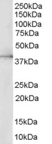 MAPK1 / ERK2 Antibody - MAPK1 / ERK2 antibody (0.5µg/ml) staining of HepG2 lysate (35µg protein in RIPA buffer). Detected by chemiluminescence.