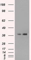 MAPK1 / ERK2 Antibody - HEK293T cells were transfected with the pCMV6-ENTRY control (Left lane) or pCMV6-ENTRY MAPK1 (Right lane) cDNA for 48 hrs and lysed. Equivalent amounts of cell lysates (5 ug per lane) were separated by SDS-PAGE and immunoblotted with anti-MAPK1.