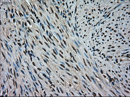 MAPK1 / ERK2 Antibody - IHC of paraffin-embedded endometrium tissue using anti-MAPK1 mouse monoclonal antibody. (Dilution 1:50).