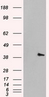 MAPK1 / ERK2 Antibody - HEK293T cells were transfected with the pCMV6-ENTRY control (Left lane) or pCMV6-ENTRY MAPK1 (Right lane) cDNA for 48 hrs and lysed. Equivalent amounts of cell lysates (5 ug per lane) were separated by SDS-PAGE and immunoblotted with anti-MAPK1.