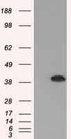 MAPK1 / ERK2 Antibody - HEK293T cells were transfected with the pCMV6-ENTRY control (Left lane) or pCMV6-ENTRY MAPK1 (Right lane) cDNA for 48 hrs and lysed. Equivalent amounts of cell lysates (5 ug per lane) were separated by SDS-PAGE and immunoblotted with anti-MAPK1.