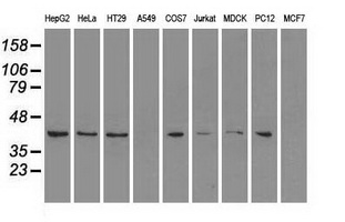 MAPK1 / ERK2 Antibody - Western blot of extracts (35 ug) from 9 different cell lines by using anti-MAPK1 monoclonal antibody.