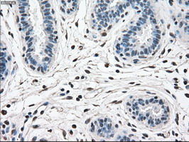 MAPK1 / ERK2 Antibody - IHC of paraffin-embedded breast tissue using anti-MAPK1 mouse monoclonal antibody. (Dilution 1:50).