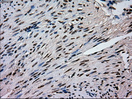 MAPK1 / ERK2 Antibody - IHC of paraffin-embedded endometrium tissue using anti-MAPK1 mouse monoclonal antibody. (Dilution 1:50).