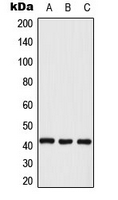 MAPK1 / ERK2 Antibody - Western blot analysis of ERK2 expression in KNRK (A); A431 (B); NIH3T3 (C) whole cell lysates.