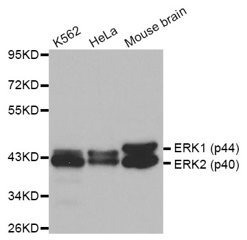 MAPK1 / ERK2 Antibody - Western blot analysis of extracts of various cell lines.