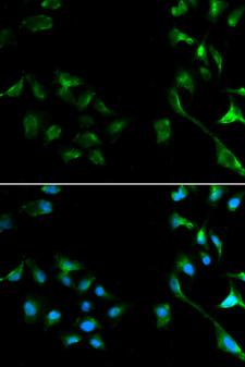 MAPK1 / ERK2 Antibody - Immunofluorescence analysis of A549 cells.