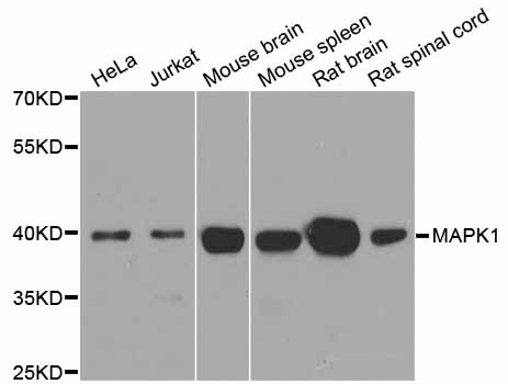 MAPK1 / ERK2 Antibody - Western blot analysis of extracts of various cell lines, using MAPK1 antibody at 1:1000 dilution. The secondary antibody used was an HRP Goat Anti-Rabbit IgG (H+L) at 1:10000 dilution. Lysates were loaded 25ug per lane and 3% nonfat dry milk in TBST was used for blocking. An ECL Kit was used for detection and the exposure time was 60s.