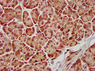MAPK1 / ERK2 Antibody - Immunohistochemistry Dilution at 1:600 and staining in paraffin-embedded human pancreatic tissue performed on a Leica BondTM system. After dewaxing and hydration, antigen retrieval was mediated by high pressure in a citrate buffer (pH 6.0). Section was blocked with 10% normal Goat serum 30min at RT. Then primary antibody (1% BSA) was incubated at 4°C overnight. The primary is detected by a biotinylated Secondary antibody and visualized using an HRP conjugated SP system.
